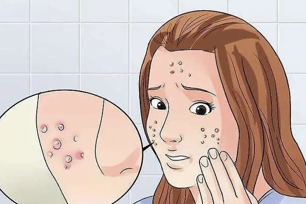 光谷天氣初美專業(yè)祛痘祛斑連鎖機(jī)構(gòu)店內(nèi)體驗(yàn)怎么樣 痘痘肌什么原因?qū)е碌? alt=