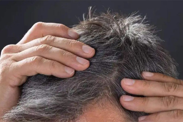 白頭發(fā)越來(lái)越多是身體哪里有問題 白頭發(fā)多和腎虛有關(guān)系嗎