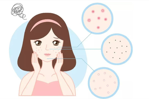 中南路skin79皮膚管理中心店清潔毛孔后感覺怎么樣 清潔毛孔幾天清潔一次最好