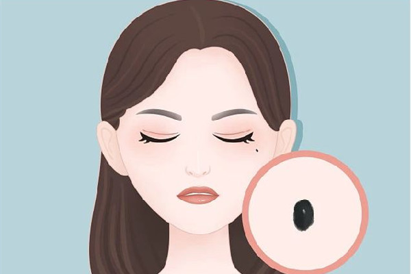 中南路正璞醫(yī)療美容·痘坑疤痕&皮膚微整店可以去痣嗎 祛痣要多久才能恢復