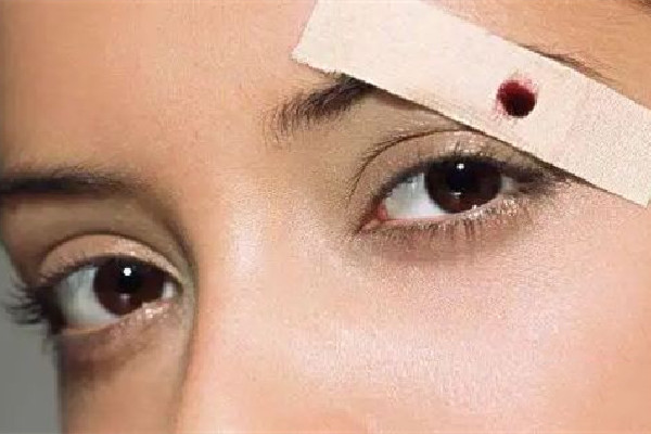 中南路美涵·半永久美睫美膚館洗眼線效果怎么樣 洗眼線是激光好還是皮秒好