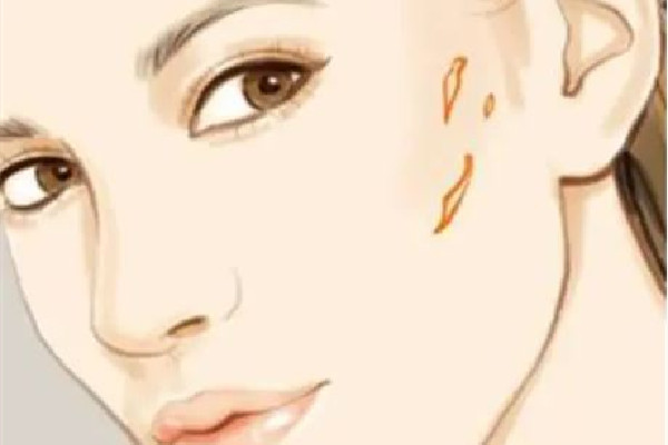 中南路欣奕除疤祛痘全國連鎖機(jī)構(gòu)祛疤效果怎么樣 祛疤是越早越好嗎