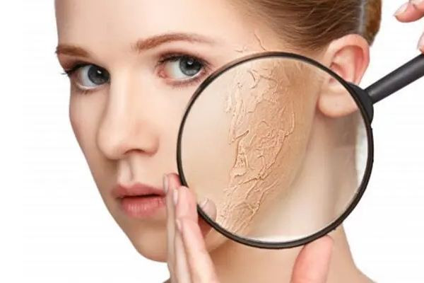 中南路丹鳳眼國際眼部美容連鎖機構可以緩解面部干燥嗎 面部干燥