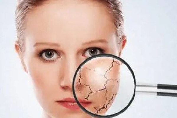 中南路丹鳳眼國(guó)際眼部美容連鎖機(jī)構(gòu)可以緩解面部干燥嗎 面部干燥怎么補(bǔ)水效果好 中南路丹鳳眼國(guó)際眼部美容連鎖機(jī)構(gòu)可以緩解面部干燥嗎 面部干燥怎么補(bǔ)水效果好