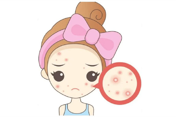 中南路Comely Lady美學中心店痘肌清潔怎么樣 痘肌多久用一次清潔面膜