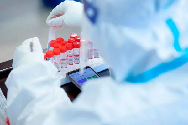 官方:抗原陽性需報(bào)備陰性正常生活 抗原檢測兩條杠一定是陽性嗎 官方:抗原陽性需報(bào)備陰性正常生活 抗原檢測兩條杠一定是陽性嗎