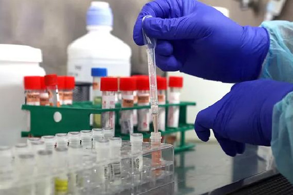 女子陽(yáng)性后跟婆婆訴苦:眼睫毛都痛 新冠陽(yáng)性為什么渾身疼 女子陽(yáng)性后跟婆婆訴苦:眼睫毛都痛 新冠陽(yáng)性為什么渾身疼