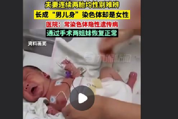 夫妻連生兩胎均患怪病性別難辨 懷孕的時(shí)候能檢查出孩子那些問題