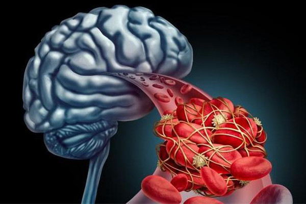 75歲老人中風(fēng)好友發(fā)現(xiàn)步數(shù)為0報(bào)警 老年人中風(fēng)要注意什么 75歲老人中風(fēng)好友發(fā)現(xiàn)步數(shù)為0報(bào)警 老年人中風(fēng)要注意什么