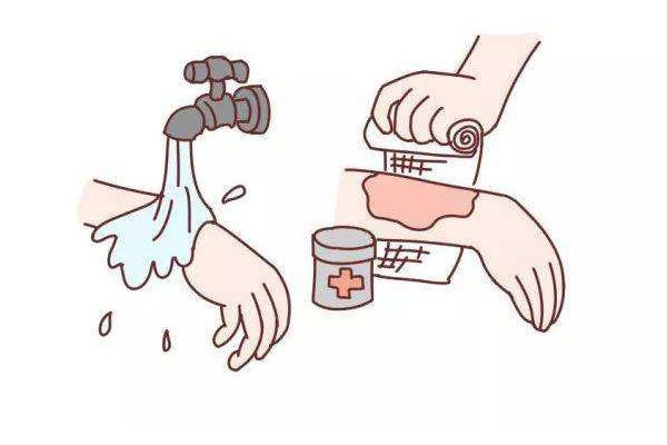 男子照顧大面積燒傷女友6年 大面積燒傷要多長時間才會恢復(fù)