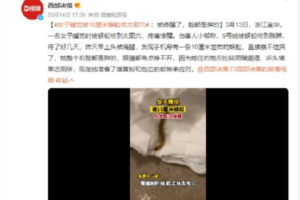 女子睡覺時(shí)被10厘米蜈蚣咬太陽穴 被蜈蚣咬了會(huì)有生命危險(xiǎn)嗎