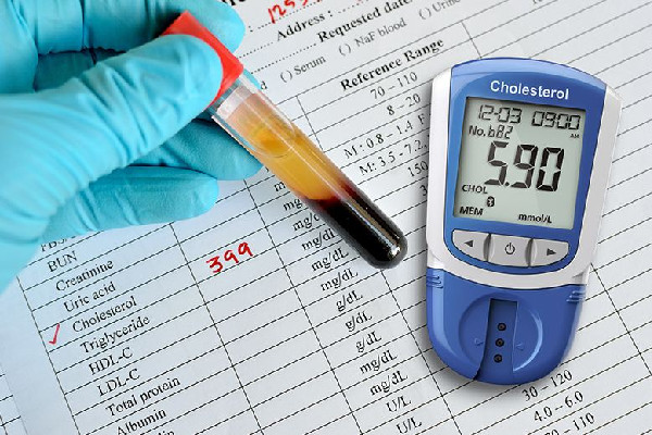 血脂檢測(cè)為何有必要從娃娃抓起 血脂檢測(cè)包括哪些項(xiàng)目 血脂檢測(cè)為何有必要從娃娃抓起 血脂檢測(cè)包括哪些項(xiàng)目