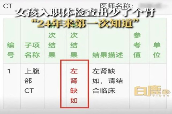 24歲女孩入職體檢查出少一個(gè)腎 體檢有什么好處 24歲女孩入職體檢查出少一個(gè)腎 體檢有什么好處